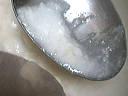 Le fromage blanc coagule peu à peu